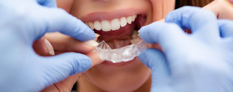 Orthodontics in Fort McMurray